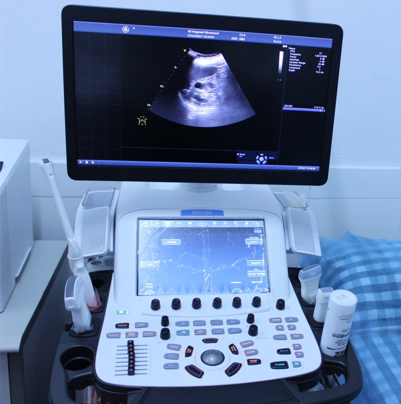 心电图机:医疗设备领域的创新升级